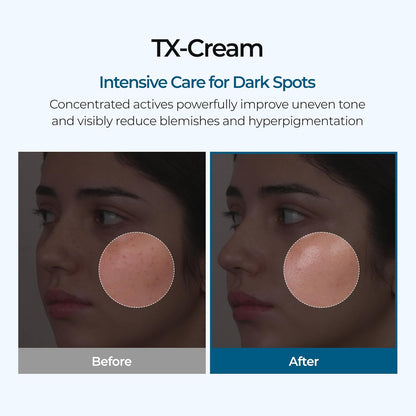 Dr. Melaxin TX Cream – Dark Spot Treatment