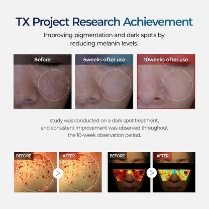 Dr. Melaxin TX Cream – Dark Spot Treatment